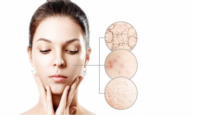 Tips and recommendations for skin blemishes and open pores.